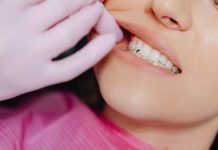 Există soluții rapide pentru înlocuirea unui dinte lipsă? Ce opțiuni există